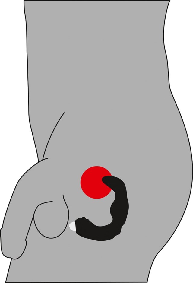 Prostate Vibrator