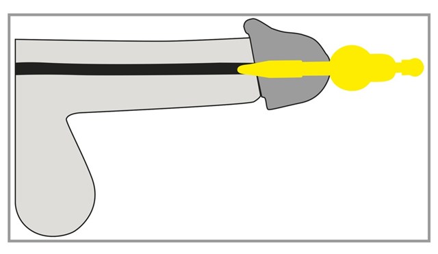 VIBRATING PENIS PLUG